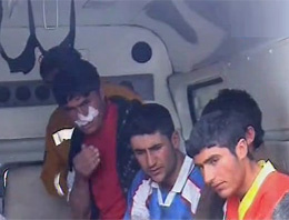 Fenerli oyuncuların burnunu kırdılar!