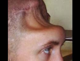 Kafatasını çiviyle tutturdular!