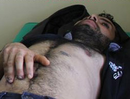 Kopan parmağı karnına dikildi