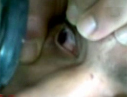 Fırka gibi göz ameliyatı (video)