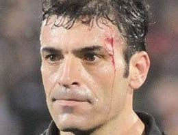 Yunus Yıldırım şikayetçi olmadı