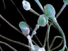 'Kimyasallar spermi azaltıyor, kanser riskini artırıyor'